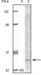 BLK Proto-Oncogene, Src Family Tyrosine Kinase antibody, NBP1-47499, Novus Biologicals, Western Blot image 