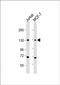 Estrogen Receptor 2 antibody, orb389114, Biorbyt, Western Blot image 