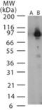 Lethal factor antibody, NB100-56667, Novus Biologicals, Western Blot image 