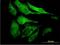 EYA Transcriptional Coactivator And Phosphatase 2 antibody, H00002139-M04, Novus Biologicals, Immunofluorescence image 