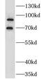 G Protein-Coupled Receptor Kinase 3 antibody, FNab03654, FineTest, Western Blot image 