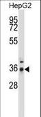Serine/threonine-protein phosphatase 4 catalytic subunit antibody, LS-C162094, Lifespan Biosciences, Western Blot image 