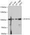 Zinc Finger CCCH-Type Containing 14 antibody, 13-607, ProSci, Western Blot image 