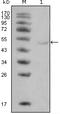 Lipoprotein lipase antibody, STJ98222, St John