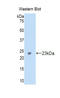 Carbonic Anhydrase 5A antibody, LS-C293145, Lifespan Biosciences, Western Blot image 