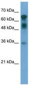EZH Inhibitory Protein antibody, TA333321, Origene, Western Blot image 