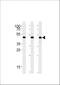 DExD-Box Helicase 39B antibody, A03490-1, Boster Biological Technology, Western Blot image 