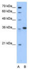 Aminoadipate-Semialdehyde Dehydrogenase-Phosphopantetheinyl Transferase antibody, TA346776, Origene, Western Blot image 