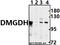 Dimethylglycine dehydrogenase, mitochondrial antibody, A07731-1, Boster Biological Technology, Western Blot image 