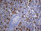 Ubiquitin Protein Ligase E3B antibody, M10679-1, Boster Biological Technology, Immunohistochemistry paraffin image 