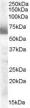 Cytochrome P450 Family 17 Subfamily A Member 1 antibody, MBS421228, MyBioSource, Western Blot image 