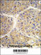 Alpha-aminoadipic semialdehyde synthase, mitochondrial antibody, 61-501, ProSci, Immunohistochemistry paraffin image 
