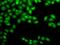 Gamma-Glutamyl Hydrolase antibody, GTX32628, GeneTex, Immunofluorescence image 