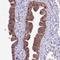 Cytoplasmic dynein 2 heavy chain 1 antibody, HPA039015, Atlas Antibodies, Immunohistochemistry paraffin image 