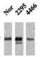 Calcium/Calmodulin Dependent Protein Kinase II Alpha antibody, TA326521, Origene, Western Blot image 