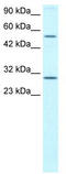 Odd-Skipped Related Transciption Factor 2 antibody, TA329324, Origene, Western Blot image 
