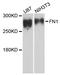 Fibronectin 1 antibody, STJ114798, St John