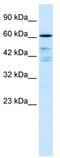 Cell Division Cycle 25B antibody, TA330366, Origene, Western Blot image 