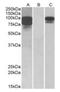 Proprotein Convertase Subtilisin/Kexin Type 9 antibody, orb125015, Biorbyt, Western Blot image 