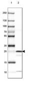 3-hydroxybutyrate dehydrogenase type 2 antibody, NBP2-32713, Novus Biologicals, Western Blot image 