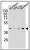 HERV-H LTR-Associating 2 antibody, AP52042PU-N, Origene, Western Blot image 