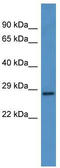 Carcinoembryonic Antigen Related Cell Adhesion Molecule 7 antibody, TA342850, Origene, Western Blot image 