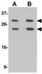 Membrane Spanning 4-Domains A6A antibody, GTX16310, GeneTex, Western Blot image 