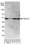 Tumor Susceptibility 101 antibody, A303-506A, Bethyl Labs, Western Blot image 