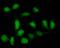 Protein Tyrosine Phosphatase Non-Receptor Type 22 antibody, A00581-3, Boster Biological Technology, Immunofluorescence image 