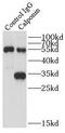 Calponin 1 antibody, FNab01221, FineTest, Immunoprecipitation image 
