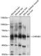 Cholinergic Receptor Nicotinic Beta 3 Subunit antibody, 13-432, ProSci, Western Blot image 
