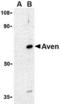 Cell death regulator Aven antibody, TA306070, Origene, Western Blot image 