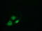 Von Willebrand Factor A Domain Containing 5A antibody, M13975, Boster Biological Technology, Immunofluorescence image 