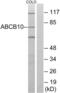 ATP Binding Cassette Subfamily B Member 10 antibody, abx014229, Abbexa, Western Blot image 