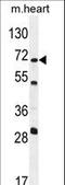 5'-Nucleotidase, Cytosolic IB antibody, LS-C163028, Lifespan Biosciences, Western Blot image 