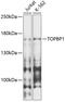 DNA Topoisomerase II Binding Protein 1 antibody, 14-518, ProSci, Western Blot image 