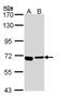 ATPase H+ Transporting V0 Subunit A4 antibody, NBP1-32904, Novus Biologicals, Western Blot image 