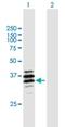 Palmitoyl-Protein Thioesterase 2 antibody, H00009374-B01P, Novus Biologicals, Western Blot image 