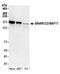 SWI/SNF complex subunit SMARCC2 antibody, A301-038A, Bethyl Labs, Western Blot image 