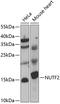 Nuclear Transport Factor 2 antibody, 22-665, ProSci, Western Blot image 