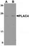 Placenta-specific protein 4 antibody, TA320132, Origene, Western Blot image 