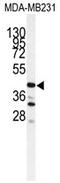 Cathepsin S antibody, AP17262PU-N, Origene, Western Blot image 