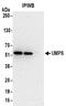 Uridine Monophosphate Synthetase antibody, NBP2-32171, Novus Biologicals, Immunoprecipitation image 