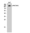 Protein Tyrosine Kinase 2 antibody, A00151Y407-1, Boster Biological Technology, Western Blot image 