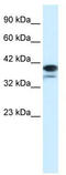 Poly(ADP-Ribose) Polymerase Family Member 6 antibody, TA334265, Origene, Western Blot image 