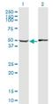 Actin Binding LIM Protein 1 antibody, H00003983-M06, Novus Biologicals, Western Blot image 