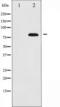 BMX Non-Receptor Tyrosine Kinase antibody, TA325278, Origene, Western Blot image 