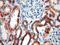 Acyl-CoA Dehydrogenase Short Chain antibody, 16623-1-AP, Proteintech Group, Immunohistochemistry paraffin image 