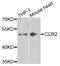 C-C Motif Chemokine Receptor 2 antibody, A2855, ABclonal Technology, Western Blot image 