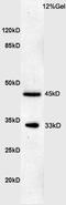 Charged Multivesicular Body Protein 4B antibody, orb100820, Biorbyt, Western Blot image 